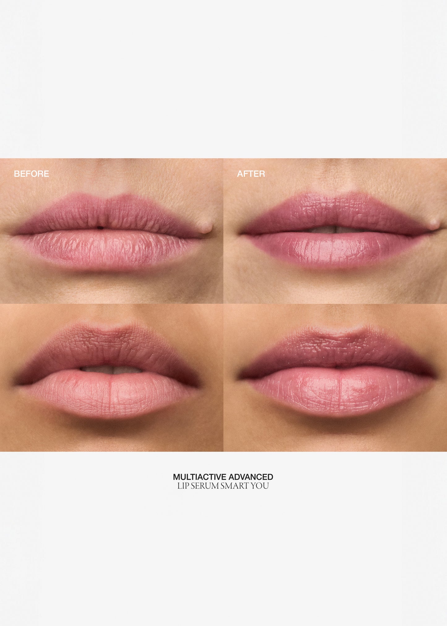 Multiactive Advanced Lip Serum Smart You